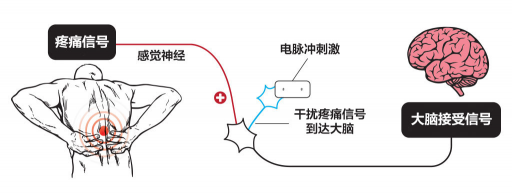 【ZE科普】一樣是電，為什么名字如此花哨