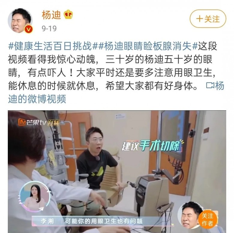 楊迪瞼板腺消失上熱搜，你的眼睛護理還敢耽誤嗎？