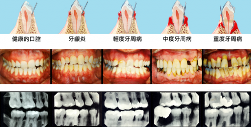 8月5日小米有品眾籌！素諾智能可視沖牙器C3 pro倒計(jì)時(shí)海報(bào)曝光