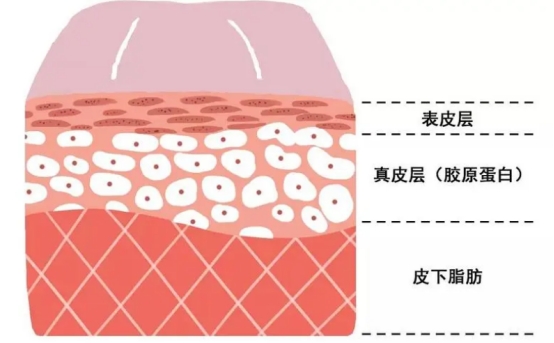 不做表面功夫，潤致娃娃針+分層抗衰讓你年齡滿40減20